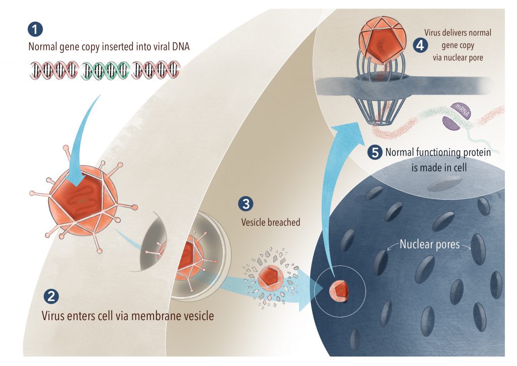 The normal gene copy is packaged into a harmless virus. The virus then breaches the target cells and delivers the normal gene copy to the cell's DNA mechanism. As a result, the cell is now making normal and functional protein.